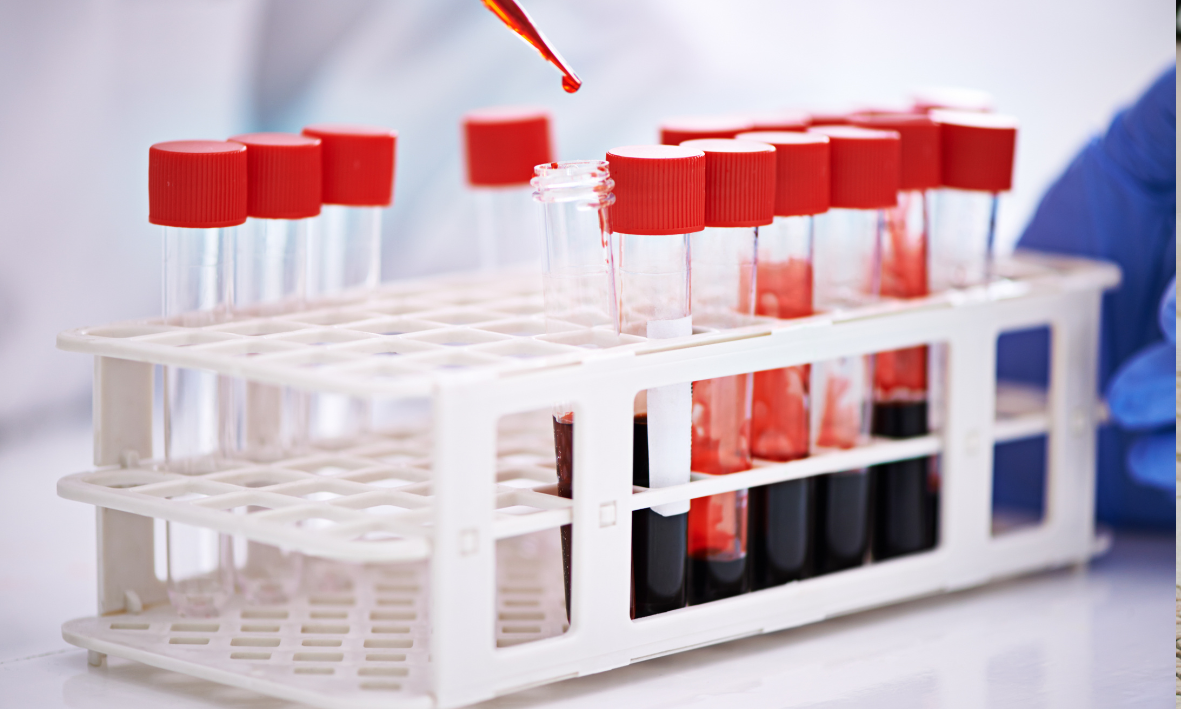 Justice delayed, justice denied: UDM on forensic backlogs and victims’ rights